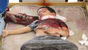 تعز: مقتل 3 مواطنيين بينهم طفلا برصاص مليشيات "أبو العباس" وسط مواجهات مع الحملة الأمنية