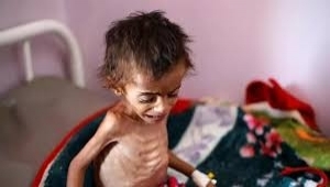 مسؤول أممي: أولويتنا في اليمن هي منع انتشار المجاعة قبل نفاد الوقت