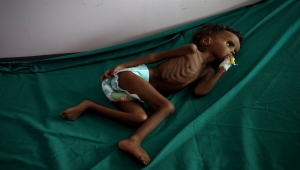 "الأطفال الجوعى لايبكون".. صحيفة أمريكية : اليمن هي عاصمة المعاناة الانسانية 