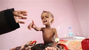 الصحة العالمية: طفل من اثنين في اليمن مهدد بسوء التغذية الحاد