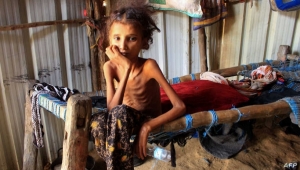 الغذاء العالمي: الجوع يتزايد كل يوم في اليمن