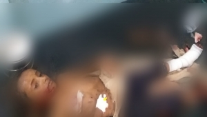 إصابة طفلتين وامرأة بلغم حوثي بحيس جنوبي الحديدة