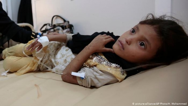 الأمم المتحدة تعلن ارتفاع وفيات الكوليرا باليمن إلى 705 حالة منذ بداية العام