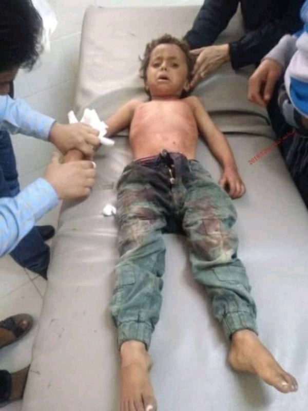 إصابة  طفل برصاص قناص حوثي في الشقب جنوب تعز(صورة )