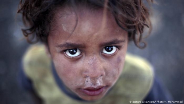 الولايات المتحدة تؤكد نية المانحين وقف المساعدات لمناطق الحوثيين