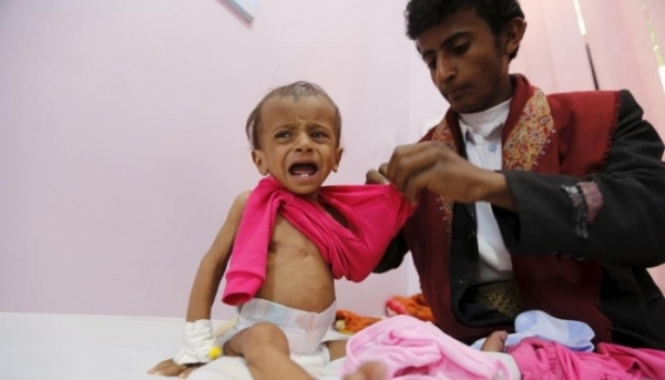مسؤول أممي يحذر أن  اليمن قادم على حافة المجاعة ويطالب المجتمع الدولي بالتدخل العاجل