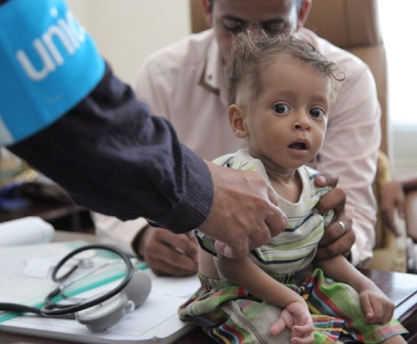 اليونيسف: مليونا طفل يمني يعانون من سوء التغذية الحاد