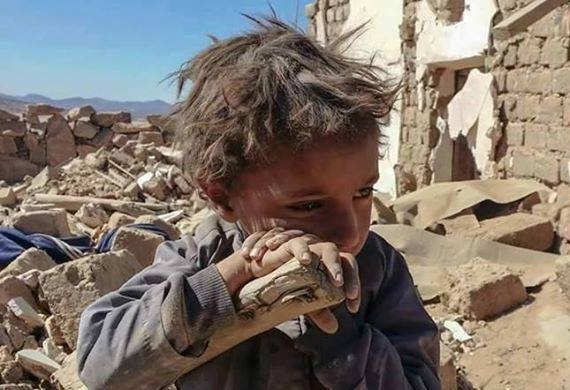 الأمم المتحدة: وفاة 233 ألف يمني لأسباب تتعلق بالنزاع اليمني