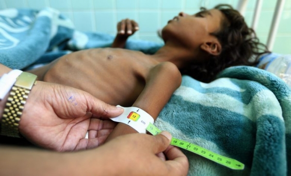 الصحة العالمية: 5 ملايين يمني معرضون لخطر المجاعة في العام الجاري