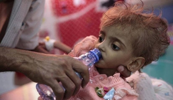 تليجراف: طفل يمني يموت كل 75 ثانية