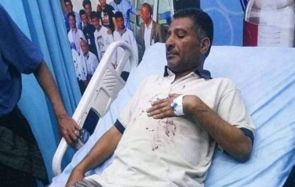 صنعاء.. تعرض صحفي للضرب المبرح من قبل عصابة