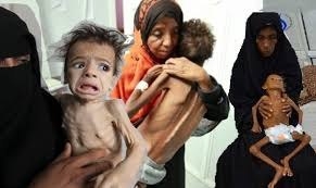 الأمم المتحدة: كل 10 دقائق يموت طفل في اليمن