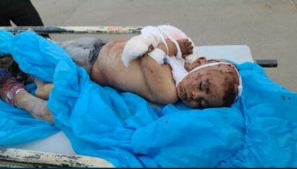 الحكومة: 35 قتيلا وجريحا بينهم أطفال ونساء بهجمات صاروخية للحوثيين على مأرب