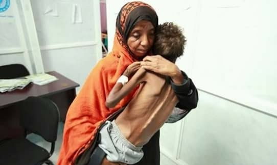 الأمم المتحدة تُحذّر من انزلاق اليمن إلى حافة الهاوية