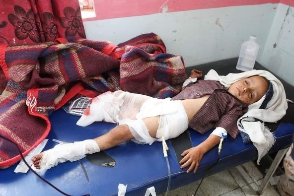  اليونيسيف: مقتل وإصابة أكثر من 10 آلاف طفل في اليمن