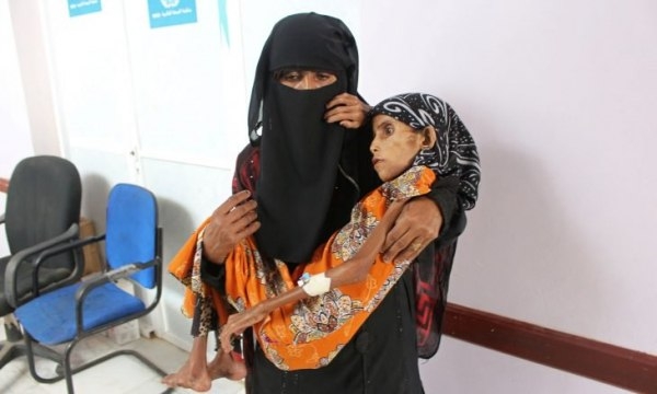 تحذيرات أممية من أن 70 بالمئة من اليمنيين بحاجة لمساعدات منقذة للحياة