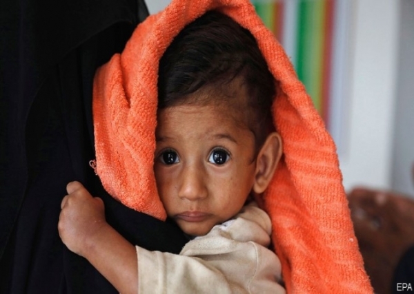 مسؤول أممي: اليمن بات "أزمة طوارئ مزمنة"