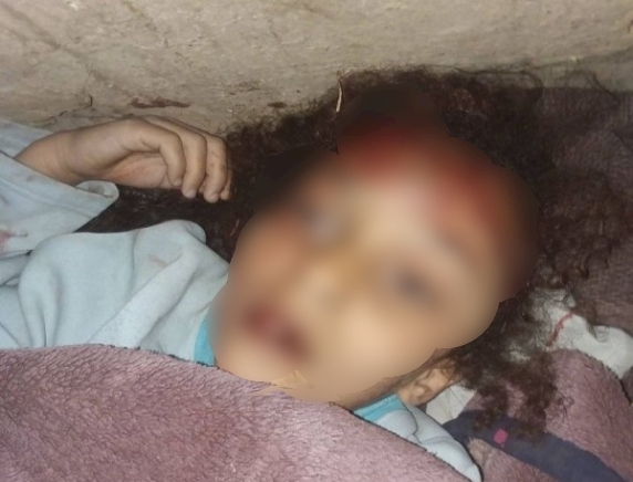 مواطن يقتل ابنته ضرباً في إب