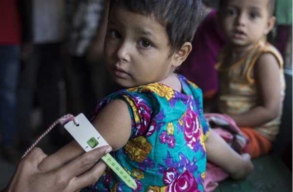 اليونيسف تحذر من تأثير أزمة الجوع العالمية على الأطفال