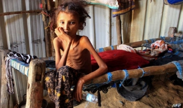 الأمم المتحدة تحذّر من خطر المجاعة في اليمن في ظل نقص تمويل خطة الاستجابة الانسانية