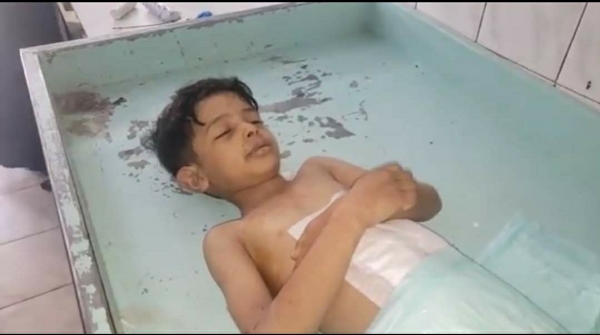 انقاذ الطفولة: مقتل أو إصابة طفل كل يوم في اليمن خلال العام الجاري