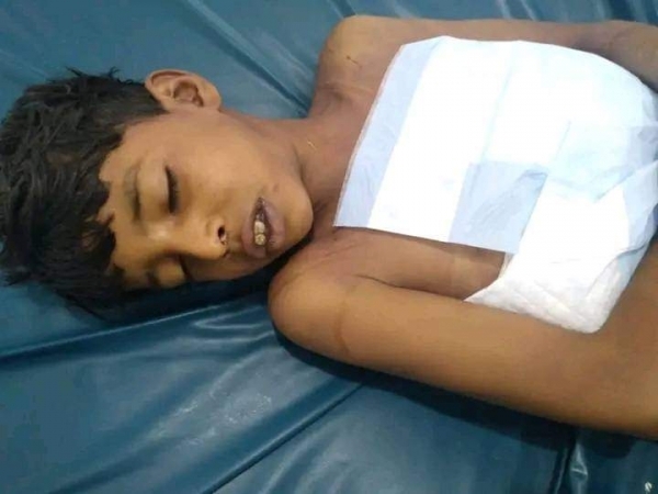 جنيف: رابطه حقوقية توثق مقتل وإصابة أكثر من 14 الف طفل في اليمن
