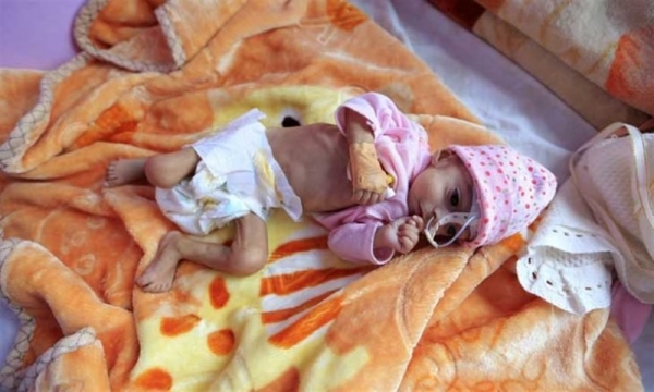 من يجنب أطفال اليمن شبح مجاعة محدقة؟