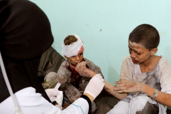 اليونيسف: مقتل وإصابة أكثر من 11 ألف طفل خلال الحرب في اليمن