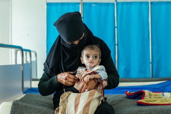 اليونيسف: أكثر من 2.2 طفل يمني يعانون من سوء التغذية الحاد