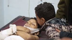 "سام" تطالب بتحرك دولي لوقف الانتهاكات الحوثية ضد الأطفال في اليمن