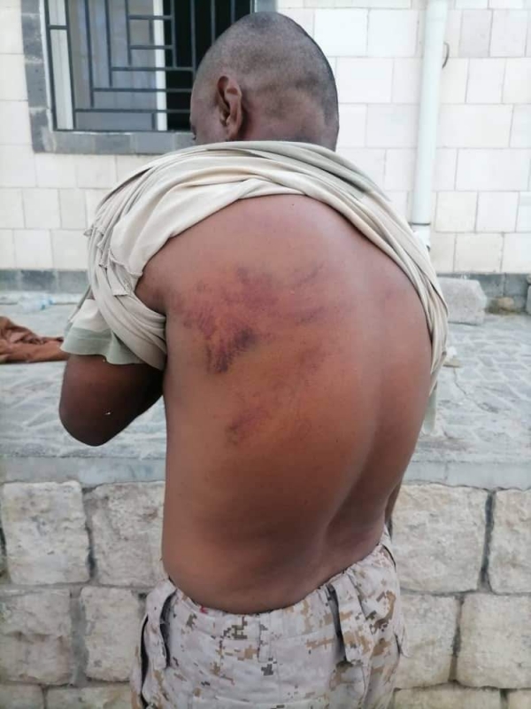حلف قبائل حضرموت يطالب بإنصاف 60 جنديًا تعرضوا للاعتداء في معسكر تشرف عليه الإمارات