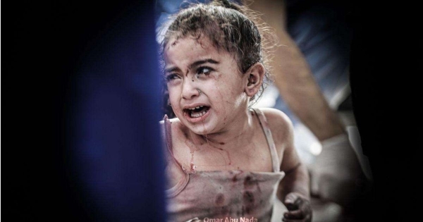 الأورومتوسطي: القتلى الأطفال بغزة في أقل من شهر 10 أضعاف نظرائهم الأوكرانيين في عام