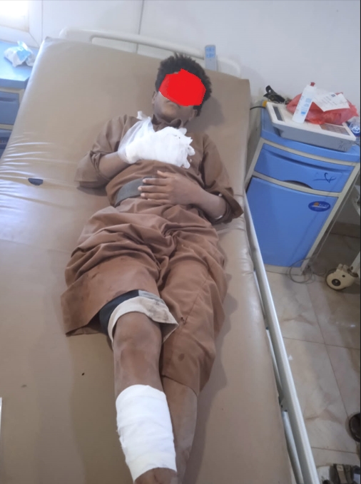 إصابة طفل جراء انفجار مقذوف من مخلفات الحرب في مخيم للنازحين بمأرب
