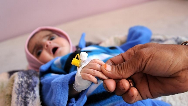 منظمة دولية تسجل 1336 حالة كوليرا باليمن خلال شهرين وتحذر من تحوله إلى وباء 