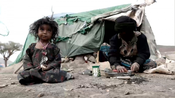 الأمم المتحدة: اليمن يعاني أحد أعلى معدلات سوء التغذية المسجلة على الإطلاق