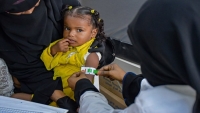 بأكثر من 4 ملايين دولار.. دعم أمريكي جديد لمواجهة سوء التغذية لدى الأطفال في اليمن