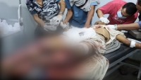 مرصد: إصابة شاب بجروح خطيرة جراء انفجار لغم للحوثيين في حجة